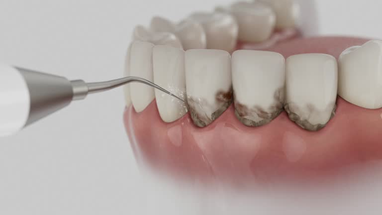 Trusted Teeth Cleaning And Checkup service in Frazer, PA - Dentist Open Now